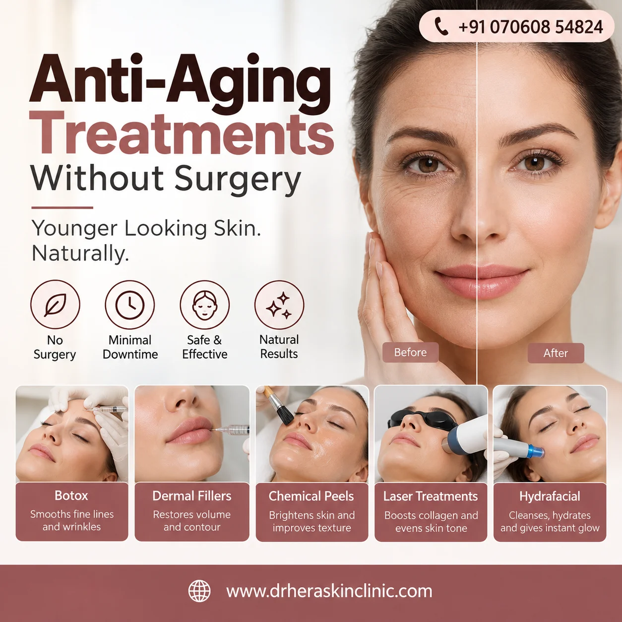 Anti-Aging Treatments Without Surgery